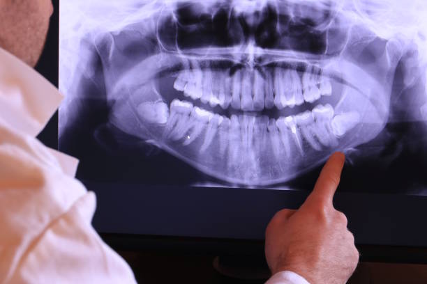 Best Emergency Broken Tooth Repair in Lockhart, FL